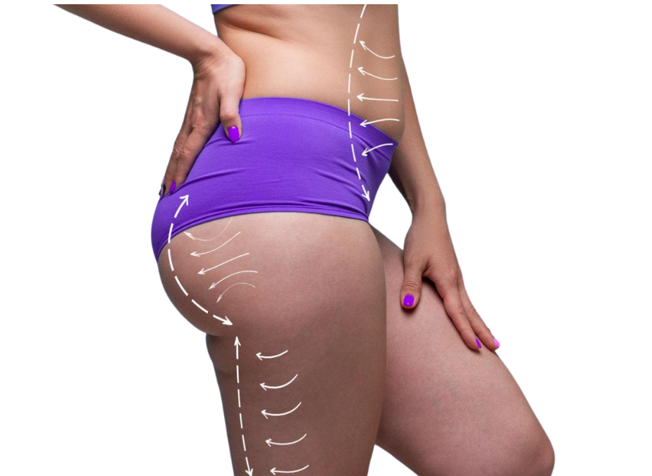 Inner Thigh Contouring – RejuveenMD Palo Alto