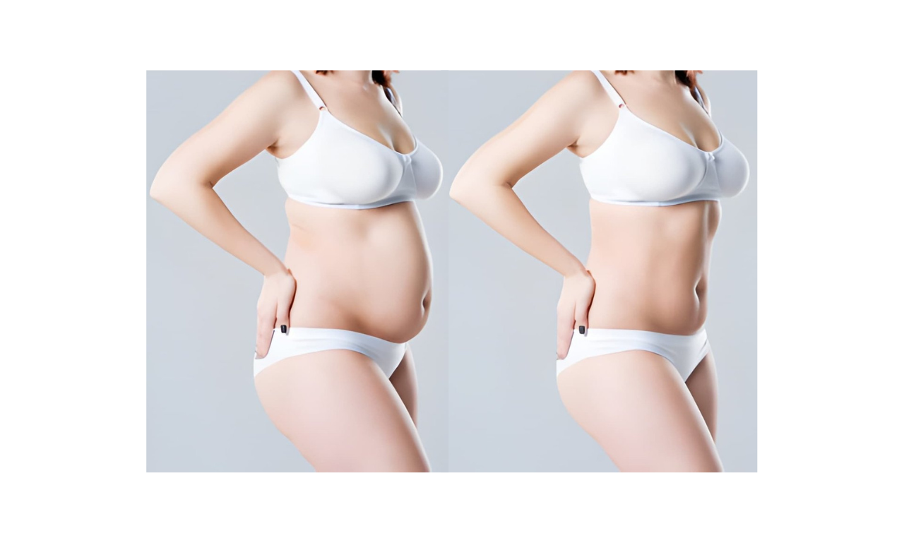 Rejuveen liposuction patient care — body, chin and facial lipo